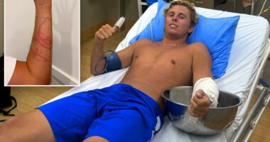 Australian surfer miraculously survives attack from âworldâs most venomous animalâ